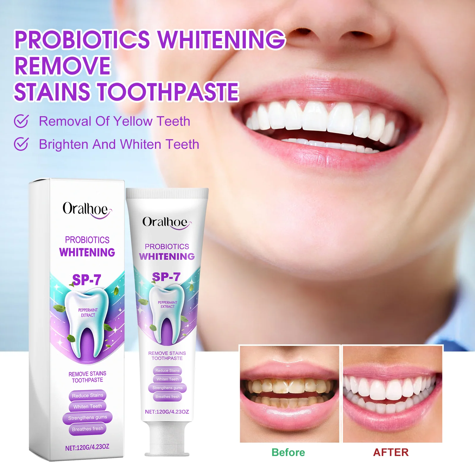 Probiotic Whitening Toothpaste for a Brighter Smile
