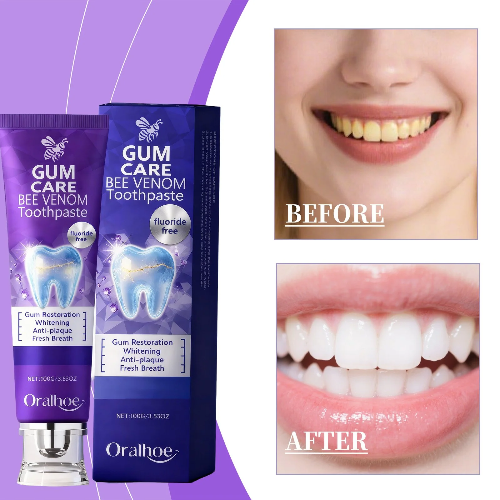 Whitening Toothpaste